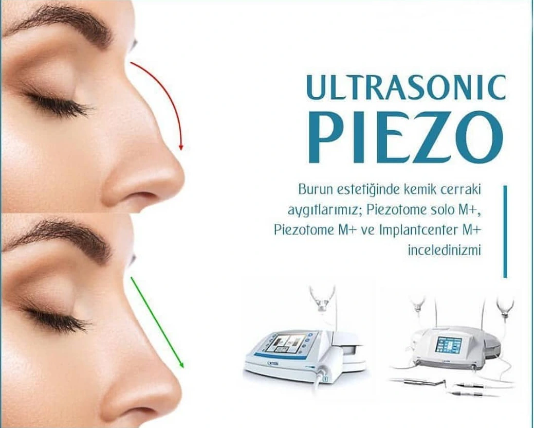 Ultrasonik Piezo ile Rinoplasti